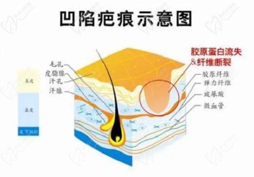谷培俊医生做疤痕手术好