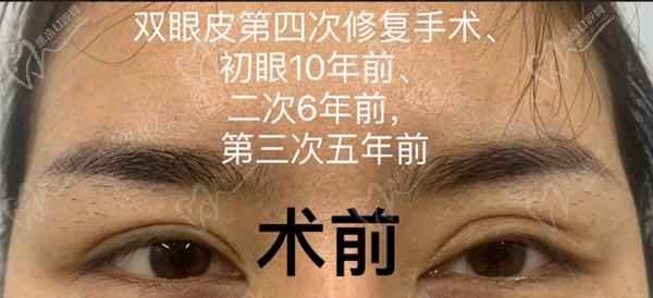 庄成全医生个人简历