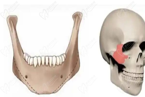 郭军磨骨在上海哪个医院 郭军磨骨在上海哪个医院