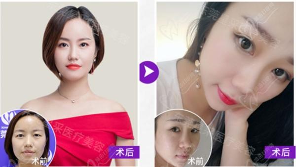 吕方中医生口碑