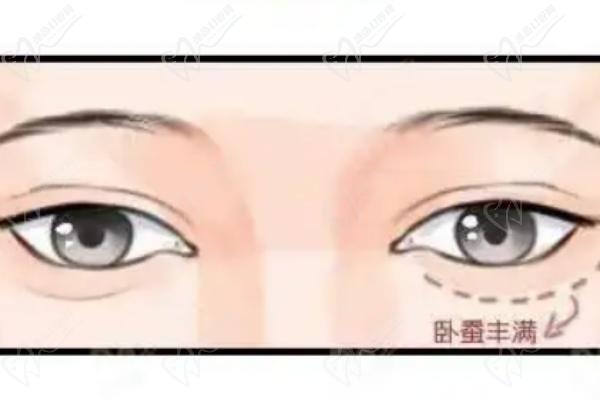 海九慕医疗美容医院眼袋手术费用是多少