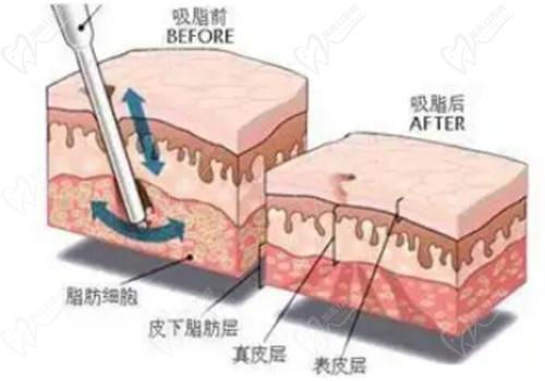 深圳斯良洪有做失败实例吗？