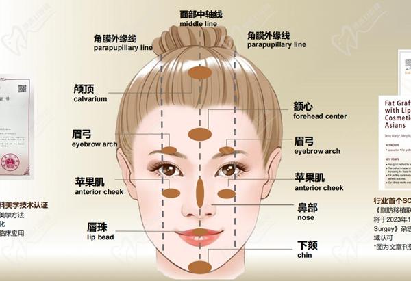 北京艺美王东修复脂肪好不好
