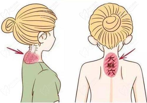 广州李方伟做富贵包技术优势