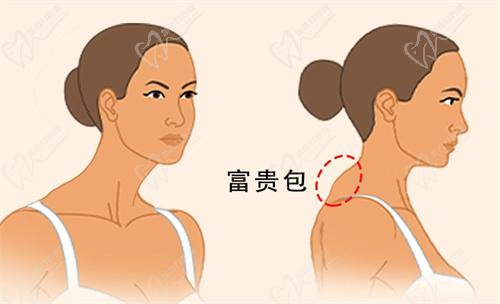 李方伟医生怎么预约挂号