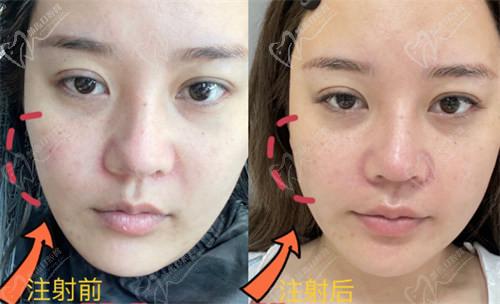 4. 【北京丽星翼美医疗美容整形收费价格表】皮肤美容项目收费标准