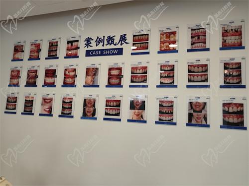 5. 【北京丽星翼美医疗美容整形收费价格表】口腔美容项目收费标准