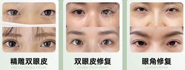 魏志香医生做高难度眼睛修复怎么样