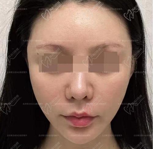 杨俊医生在北京口碑和评价