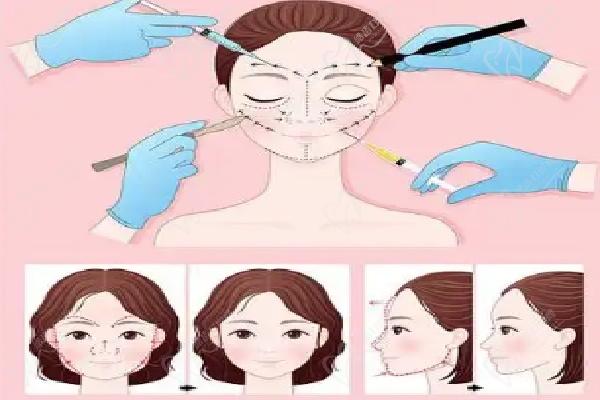 武汉艺星朱胜军打除 皱针注射过程详解