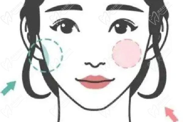 武汉艺星朱胜军打除 皱针预约挂号