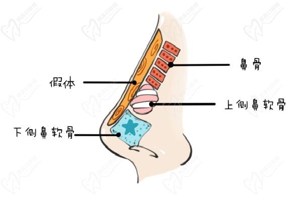 杨水斌医生鼻整形手术口碑怎么样