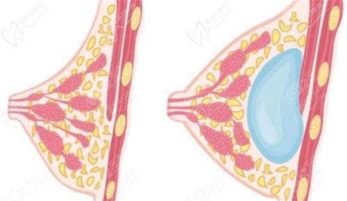 三、医院医生团队推荐(重点推荐蒋铮铮) 三、医院医生团队推荐(重点推荐蒋铮铮)