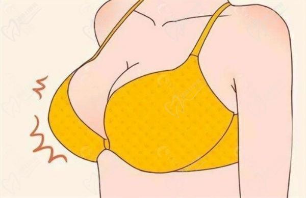 广州李俊明医生隆胸实例分享 广州李俊明医生隆胸实例分享