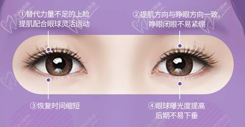 杭州杨连华双眼皮修复做的好