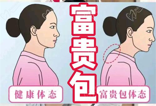 广州李方伟医生口碑评价