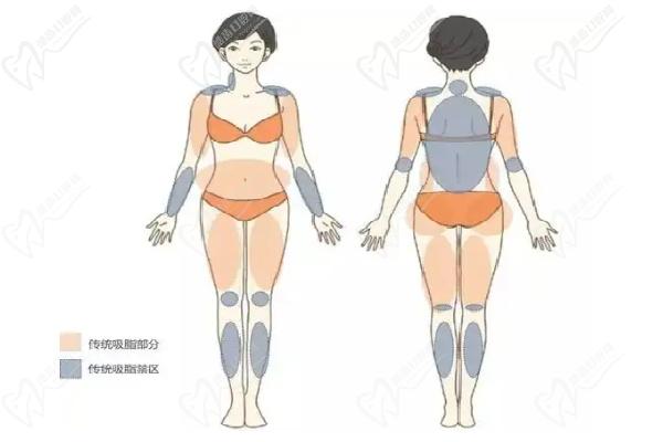 北京郑京桓医生做吸脂出诊信息