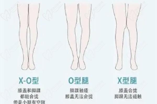 郑京桓医生预约挂号做吸脂方式