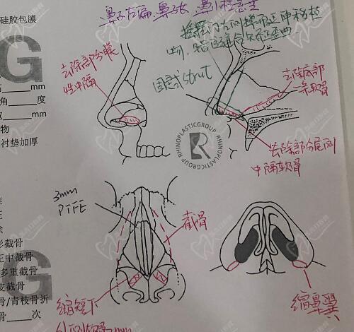 预约李信锋医生的详细流程