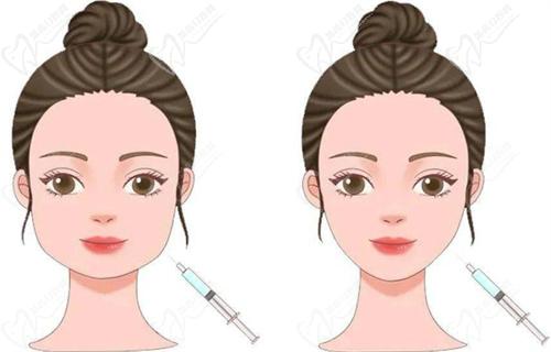 帝百珂胶原一型和三型成分与结构