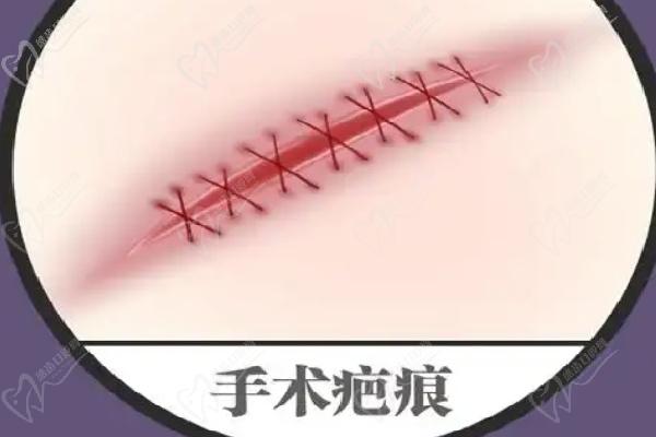 北京烧伤疤痕修复医院排名