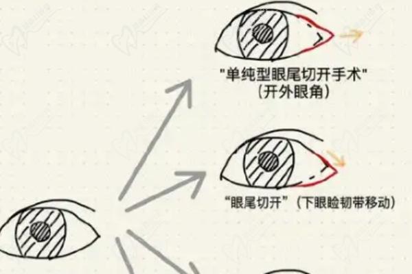北京北京鲁礼新医生做鼻子和双眼皮医费用查询