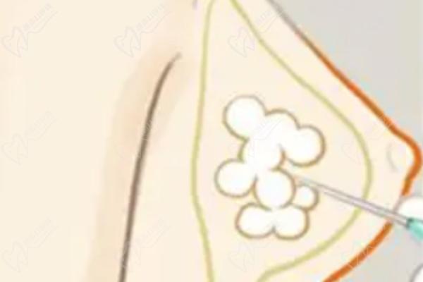 李立仲坐诊医院出诊信息 李立仲坐诊医院出诊信息