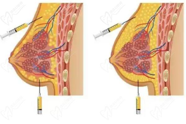 李立仲核心技术解析——为什么选TA 李立仲核心技术解析——为什么选TA