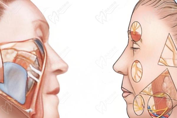 杨俊拉皮属于什么档次