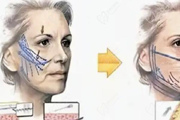 预约杨俊医生挂号预约