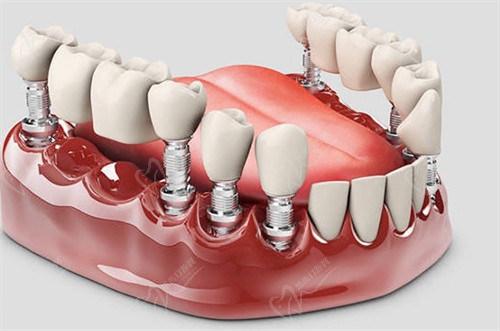 1713316890368 - 副本.jpg