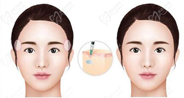 西安徐智慧医生怎么样 西安徐智慧医生怎么样