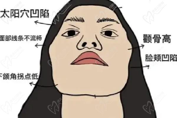 北京艺美王东降颧骨预约与就诊指南