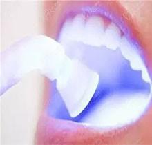 牙齿冷光美白是什么？对牙齿有什么危害吗？