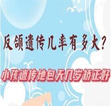 反颌遗传几率有多大?小孩遗传地包天几岁矫正好?