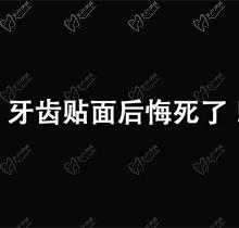 后悔做了牙贴面觉得好厚感觉像龅牙怎么办呢？可以去除吗？