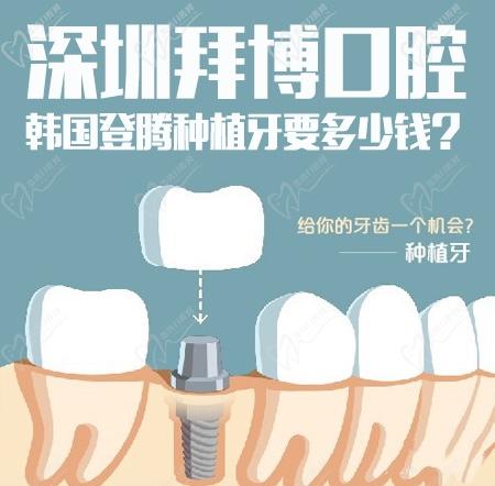 深圳拜博口腔韩国登腾种植牙要多少钱？3999元的种植牙是骗局吗？