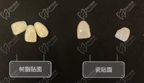 牙齿瓷贴面和树脂贴面有什么区别？树脂和全瓷选哪个好？