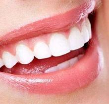 做了皓齿美白需要注意什么？ 能保持多久？