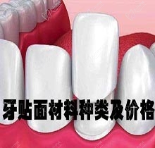 全口牙齿贴片要多少钱？求个牙贴面材料种类及价格