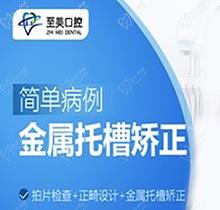 张家口至美口腔金属托槽矫正仅5288元起，面型改善更有效