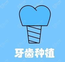 深圳同步齿科种植牙怎么样？看医生实力种植牙挺靠谱