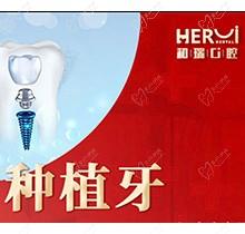 杭州和瑞口腔韩国登腾种植牙5999元起，技术好放心种植