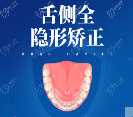广州博德美加口腔舌侧隐形矫正49999元起,真隐形不伤牙量齿定制!