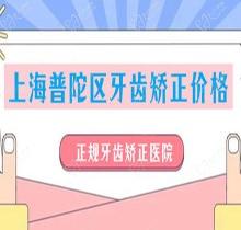 我有上海普陀区牙齿矫正价格清单，正规牙齿矫正医院也介绍给你