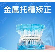 北京乾德齿科青少年牙齿矫正16750元起，早正畸早放心！