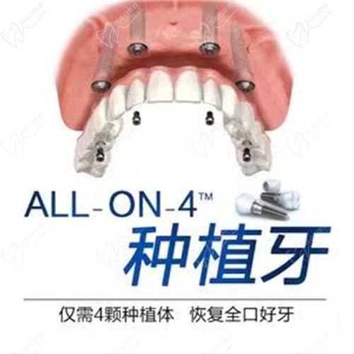 长沙种植牙美奥口腔医院技术好,诺贝尔单颗九千八起含医生介绍