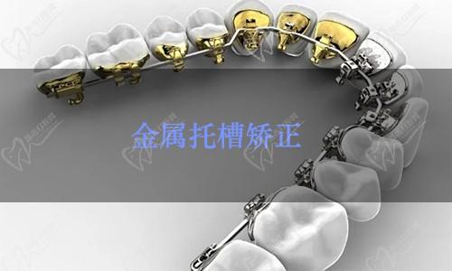 无锡新惠口腔看牙优惠力度大，金属托槽矫正只要5800元起