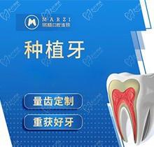 上海罗缘口腔种一颗牙价格2023！瑞典诺贝尔种植牙超值9980元起