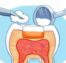广州哪家医院补牙比较好？速看广州补牙好的口腔医院排行榜